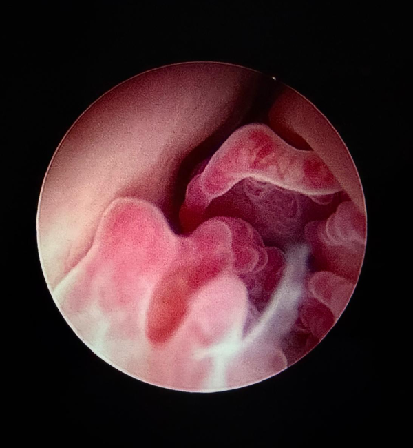 Endoscopia veterinaria para perros y gatos en Jerez
